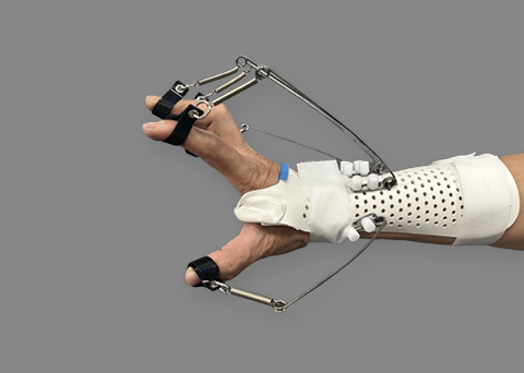 动态型掌指支具